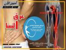 علاج طبيعي لعرق النسا في مركز العناية الخاص للعلاج الط�
